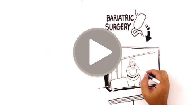 Reclaim Your Life From Chronic Obesity